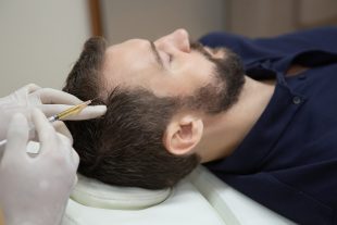 Hair mesotherapy or scalp prp: Platelet-rich plasma procedure. Beautician doctor makes injections in the man head for hair growth against hair loss and baldness